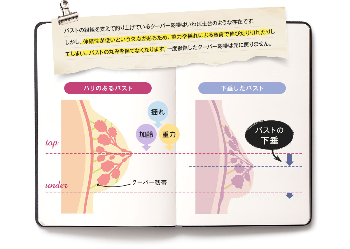 クーパー靭帯は重力や揺れによる負荷で伸びたり切れたりしてしまい、バストの丸みを保てなくなります